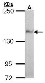 Nardilysin Antibody in Western Blot (WB)