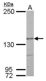 Nardilysin Antibody in Western Blot (WB)