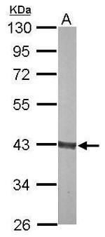 Aldolase B Antibody in Western Blot (WB)