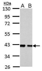 Aldolase B Antibody in Western Blot (WB)