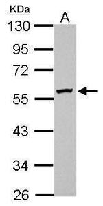 DPH2 Antibody in Western Blot (WB)