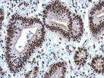 hnRNP M Antibody in Immunohistochemistry (Paraffin) (IHC (P))