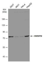 hnRNP M Antibody in Western Blot (WB)