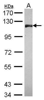 CNOT3 Antibody in Western Blot (WB)