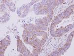 VARS Antibody in Immunohistochemistry (Paraffin) (IHC (P))