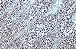 BRD3 Antibody in Immunohistochemistry (Paraffin) (IHC (P))