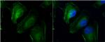 TAGLN2 Antibody in Immunocytochemistry (ICC/IF)