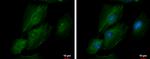 TAGLN2 Antibody in Immunocytochemistry (ICC/IF)