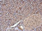 TAGLN2 Antibody in Immunohistochemistry (Paraffin) (IHC (P))