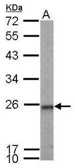 TAGLN2 Antibody in Western Blot (WB)