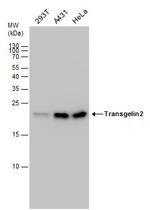 TAGLN2 Antibody in Western Blot (WB)