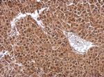 DENR Antibody in Immunohistochemistry (Paraffin) (IHC (P))