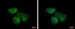 EIF2B4 Antibody in Immunocytochemistry (ICC/IF)