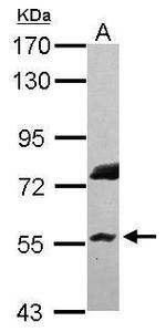 RNF8 Antibody in Western Blot (WB)