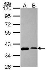 EMAP II Antibody in Western Blot (WB)