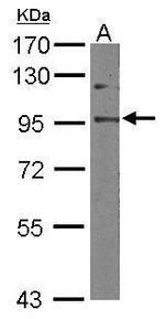 EFTUD2 Antibody in Western Blot (WB)