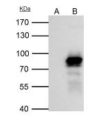 Placental Alkaline Phosphatase Antibody in Immunoprecipitation (IP)