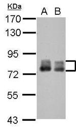 Placental Alkaline Phosphatase Antibody in Western Blot (WB)