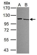 DDX23 Antibody in Western Blot (WB)