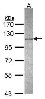 DDX23 Antibody in Western Blot (WB)