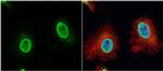 VPS4B Antibody in Immunocytochemistry (ICC/IF)