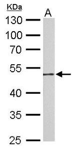 GDA Antibody in Western Blot (WB)