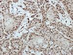 CTR9 Antibody in Immunohistochemistry (Paraffin) (IHC (P))