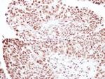 RNF40 Antibody in Immunohistochemistry (Paraffin) (IHC (P))