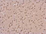 PSMD6 Antibody in Immunohistochemistry (Paraffin) (IHC (P))