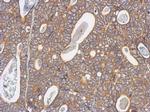 Arp3 Antibody in Immunohistochemistry (Paraffin) (IHC (P))