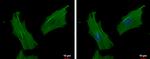 ACTR1B Antibody in Immunocytochemistry (ICC/IF)