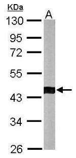 ACTR1B Antibody in Western Blot (WB)