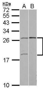 YAF2 Antibody in Western Blot (WB)