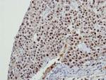 BCAS2 Antibody in Immunohistochemistry (Paraffin) (IHC (P))