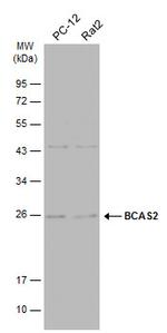 BCAS2 Antibody in Western Blot (WB)