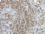 BRAF35 Antibody in Immunohistochemistry (Paraffin) (IHC (P))