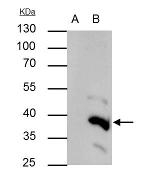 BRAF35 Antibody in Immunoprecipitation (IP)