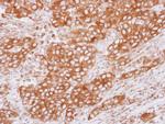 Tubulin beta-2C Antibody in Immunohistochemistry (Paraffin) (IHC (P))