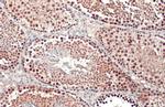 PRMT5 Antibody in Immunohistochemistry (Paraffin) (IHC (P))