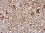 PRMT5 Antibody in Immunohistochemistry (Paraffin) (IHC (P))