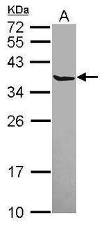 SCGN Antibody in Western Blot (WB)