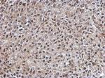 IGF2BP3 Antibody in Immunohistochemistry (Paraffin) (IHC (P))