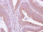 GRAP Antibody in Immunohistochemistry (Paraffin) (IHC (P))