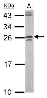 GRAP Antibody in Western Blot (WB)