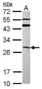 GRAP Antibody in Western Blot (WB)