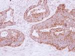 MTHFD2 Antibody in Immunohistochemistry (Paraffin) (IHC (P))