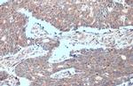 MTHFD2 Antibody in Immunohistochemistry (Paraffin) (IHC (P))