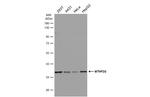 MTHFD2 Antibody in Western Blot (WB)