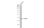 MTHFD2 Antibody in Western Blot (WB)