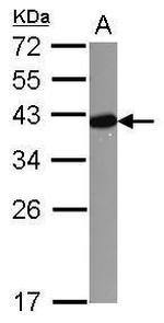 LDB3 Antibody in Western Blot (WB)